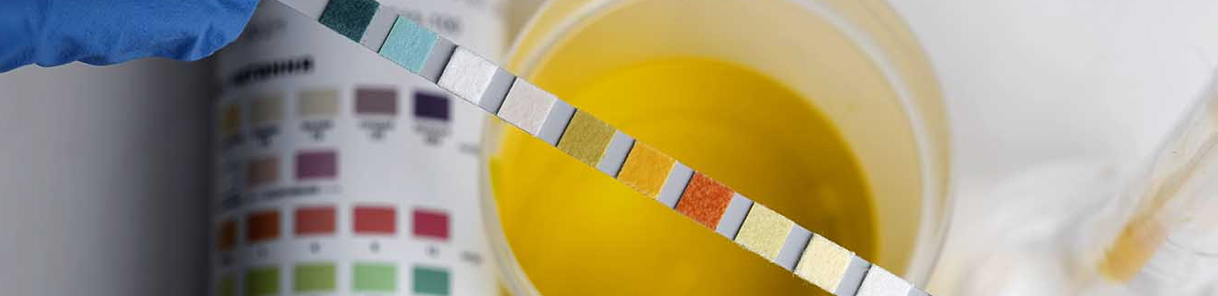Urine Examination